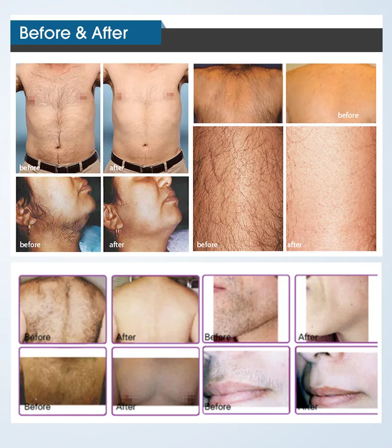 Laser Machine View 4