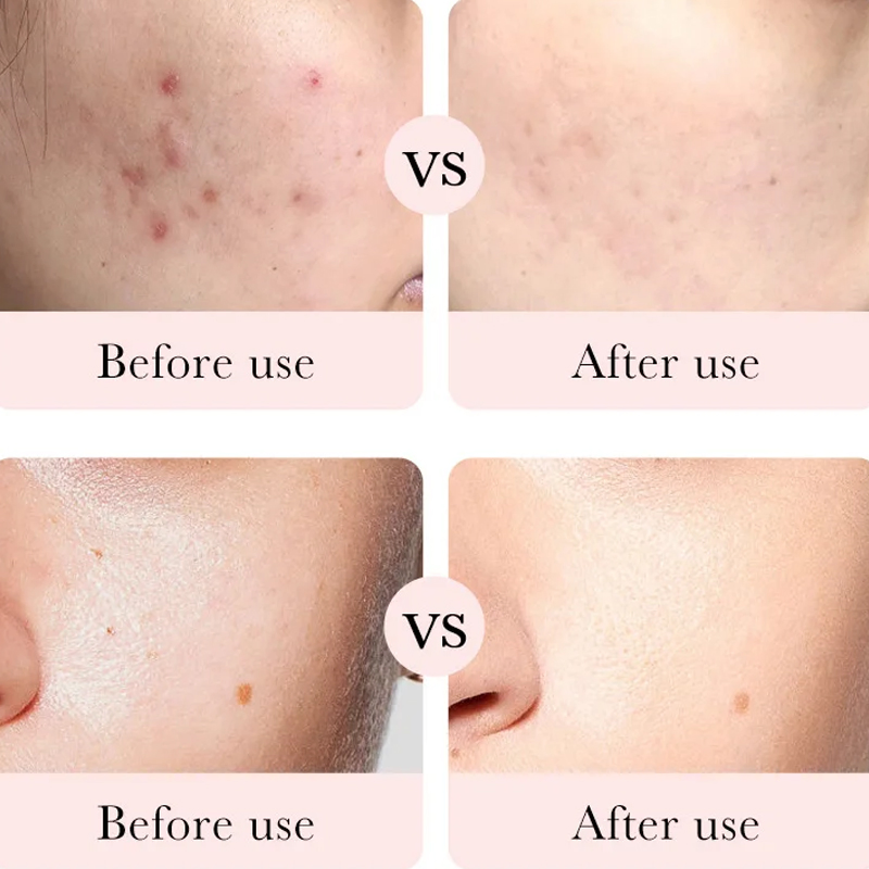 Di Tong OEM ODM Hyaluronic Acid Rose Deep Cleansing Facial Cleanser