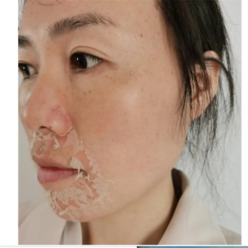 Seaweed Peeling Principle 5