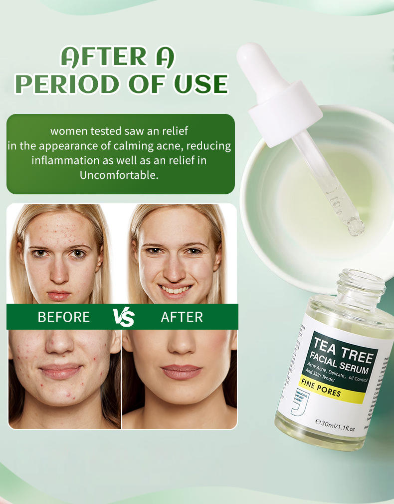 Private Label Facial Skin Care Acne Removal Oil Control Whitening Hydration Tea Tree Facial Serum