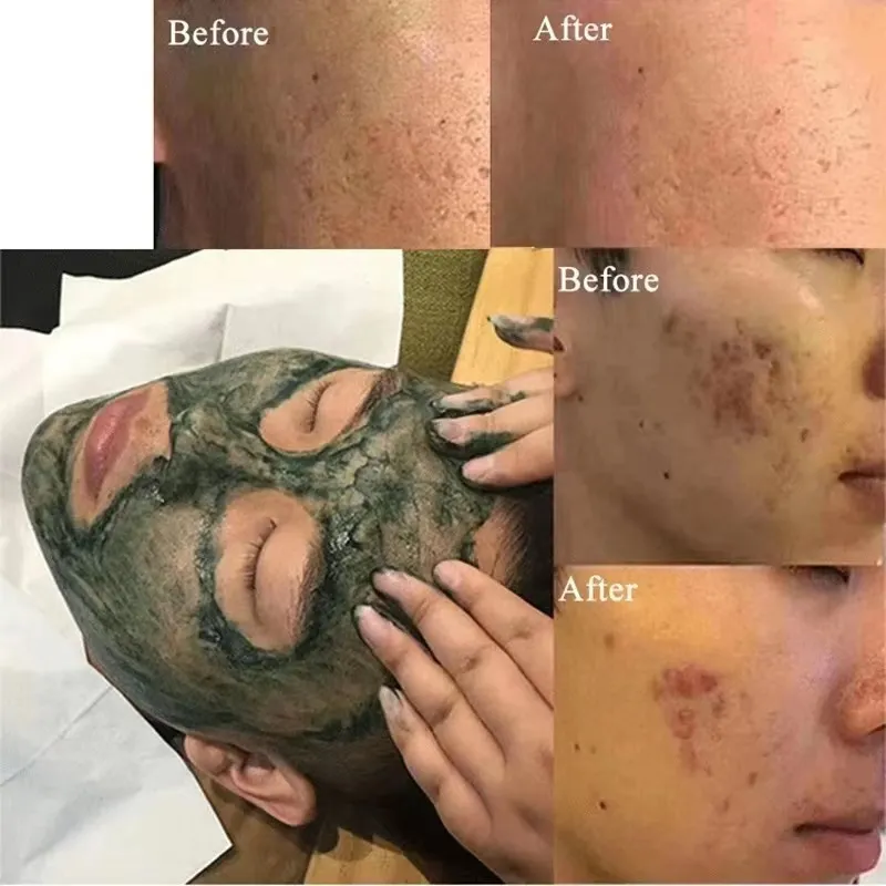 Seaweed Peeling Principle 2