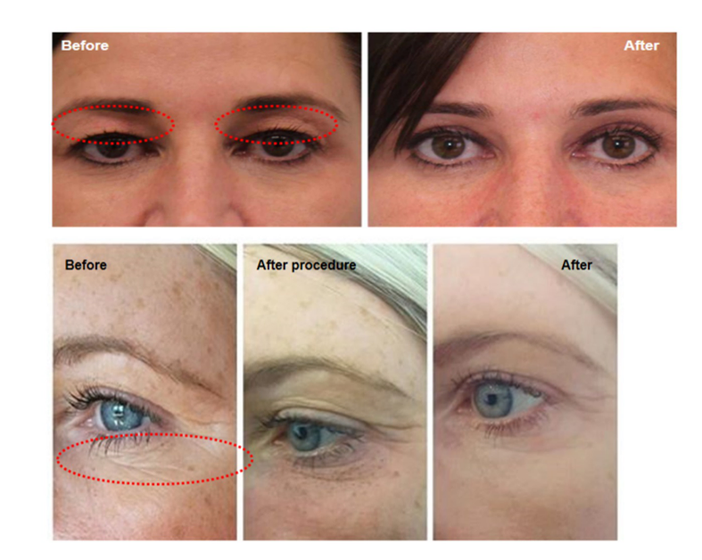 Before and After Results 2