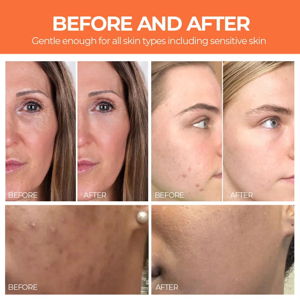 Women Pumpkin Cleansing Facial Mask Whitening Gently Exfoliating Clean Face Mask