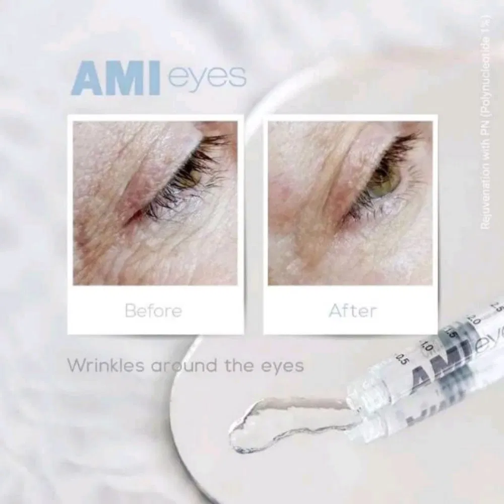 Ami Eyes Solution