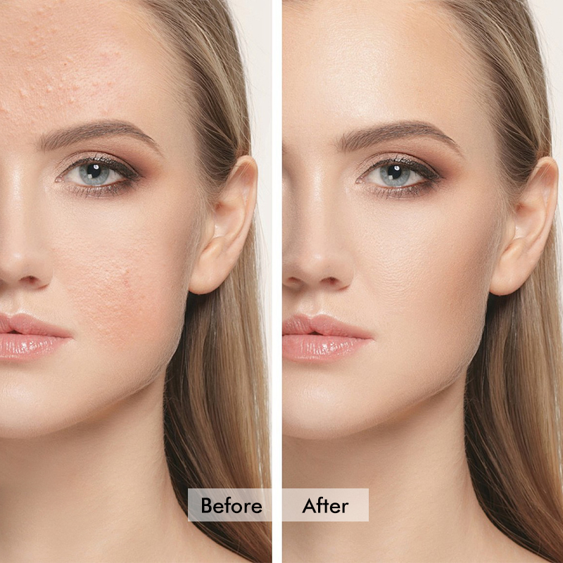 Hot Selling Nicotinamide Oil Control Face Lotion Set Pore Minimizing Brightening Skin Care Moisturizer Oily Skin Anti-Inflammatory Hydrating Collagen Synthesis