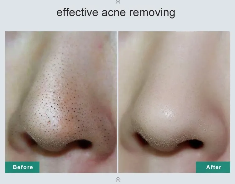 Bamboo Charcoal Facial Cleanser Display 8