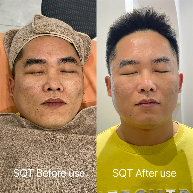 Seaweed Peeling Principle 4