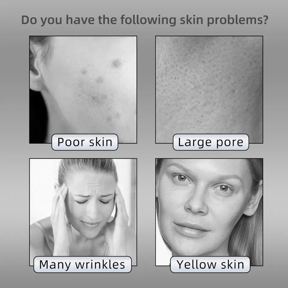 Home Use Rechargeable LED Light Therapy 4 Light Repair Skin Remove Pore Wrinkle Anti Aging LED Facial Mask