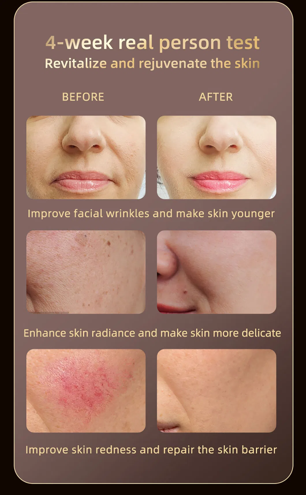 Beauty Facial Mask 4