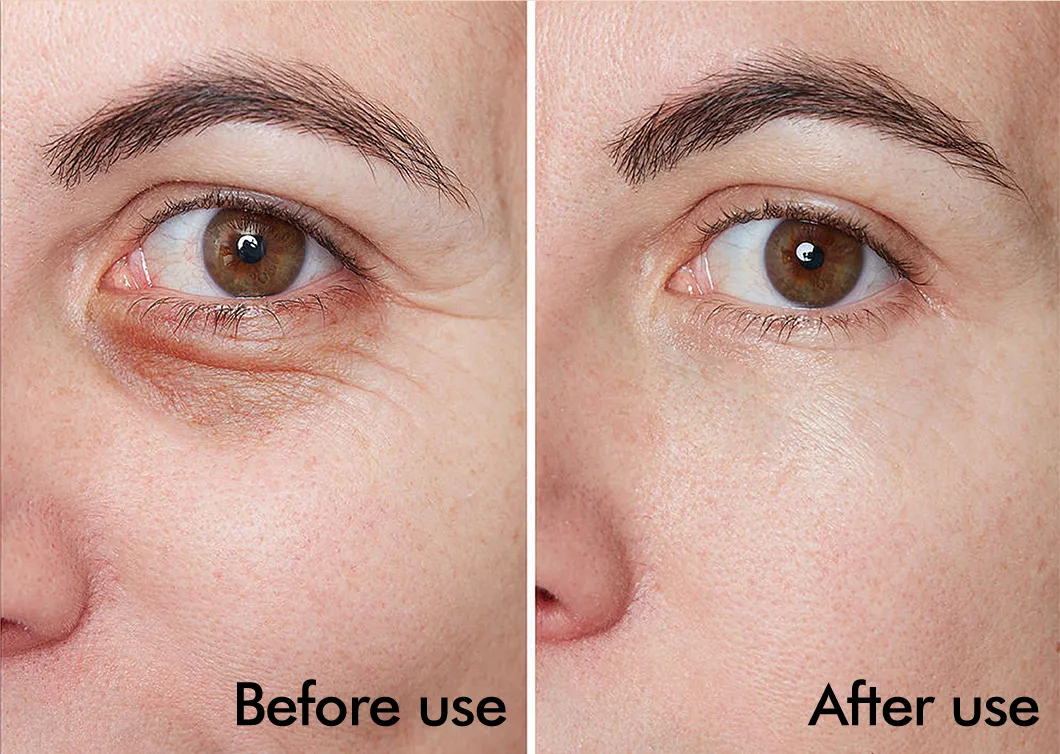 Eye Care Product Details 4