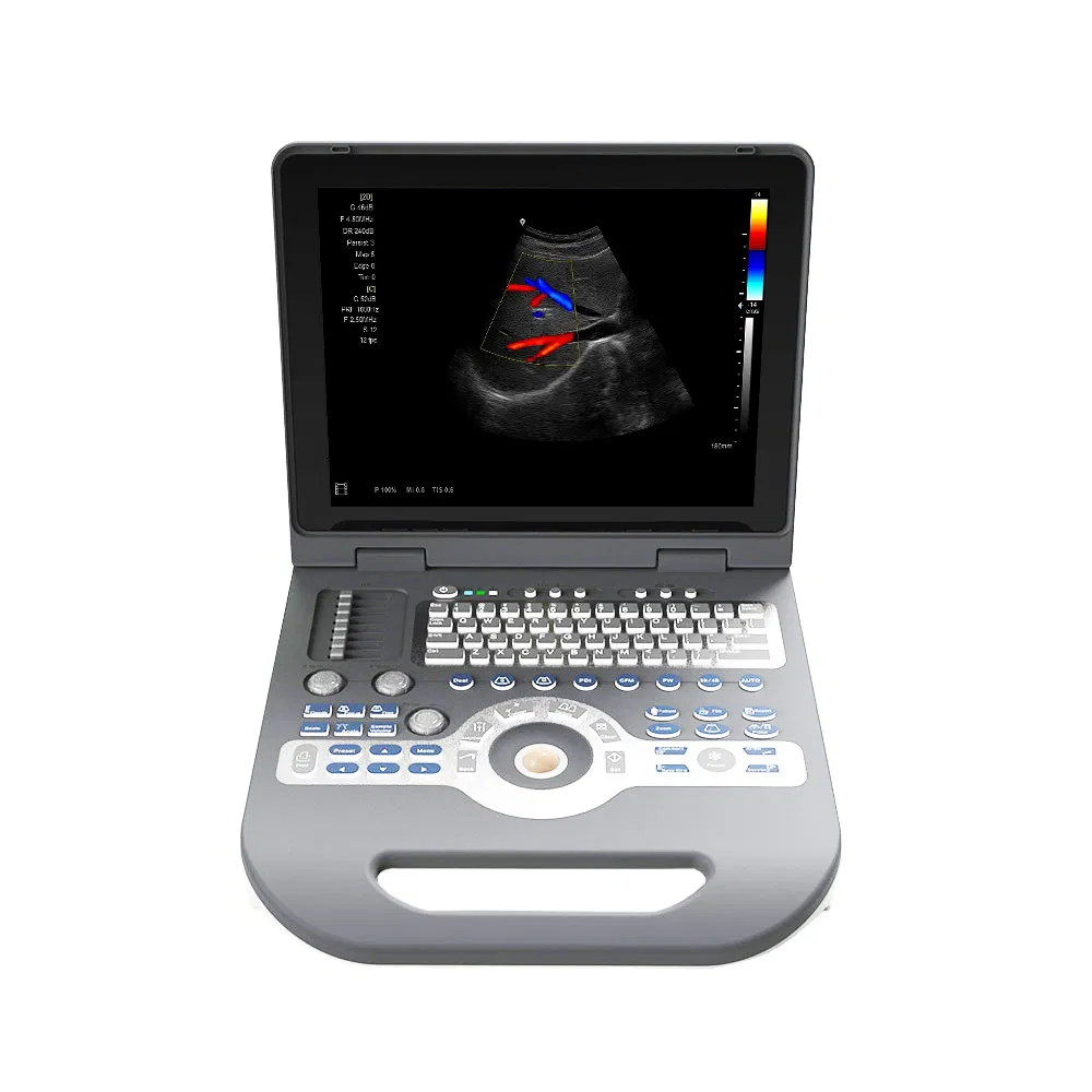 Ltub65 Económico 3D/4D Sistema de Ultrasonido Doppler Color Portátil