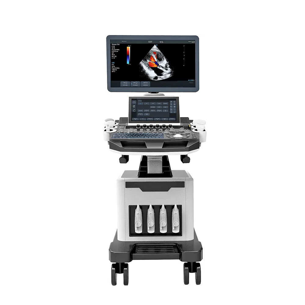 Sistema de ultrasonido médico móvil