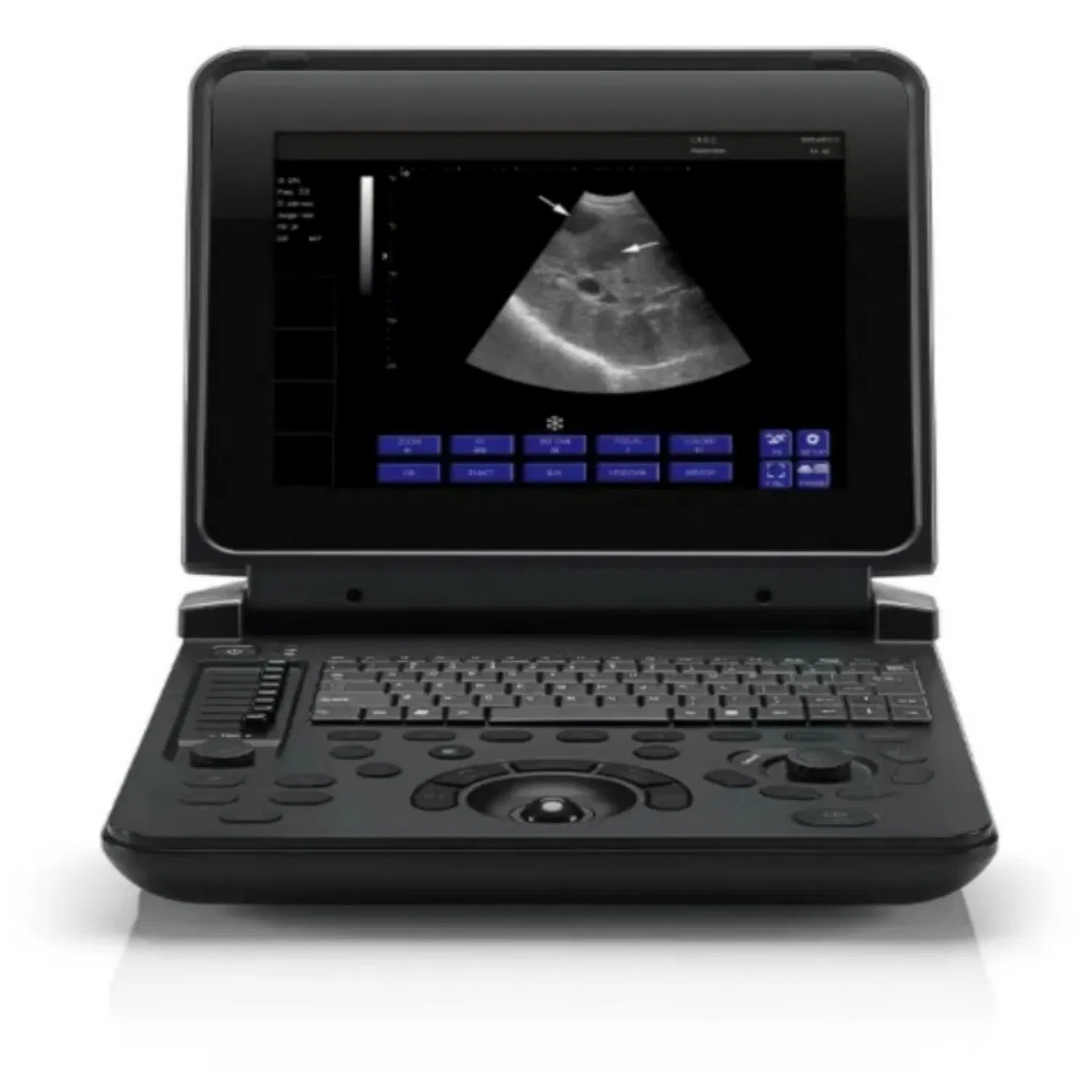 Escáner portátil de ultrasonido veterinario económico para uso en bovinos y equinos con sonda rectal