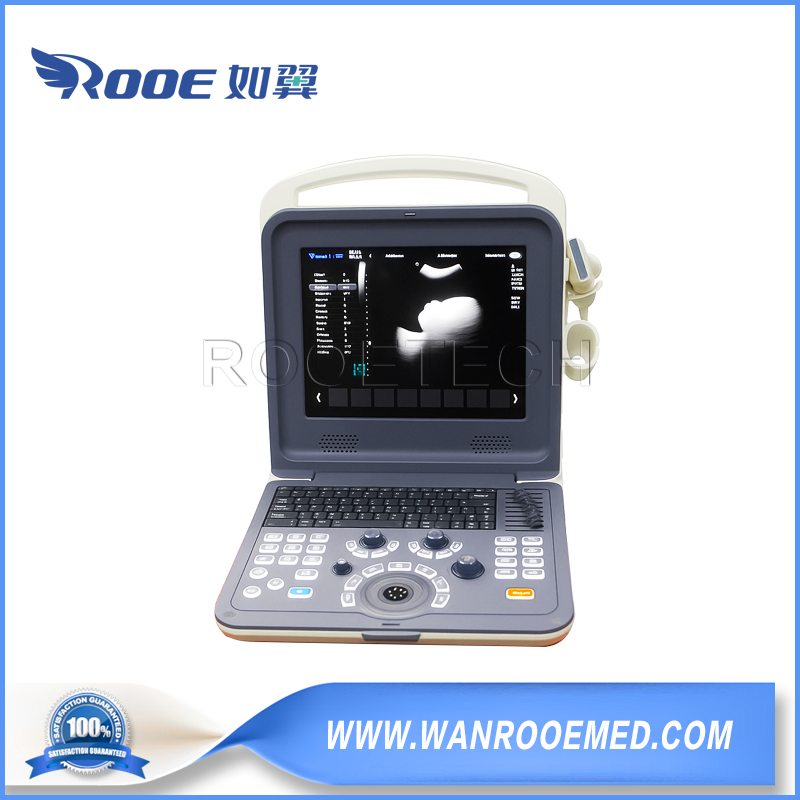 Estilo de cuaderno 2/4D Máquina de ultrasonido portátil escáner de ultrasonido Doppler color para ginecología y obstetricia