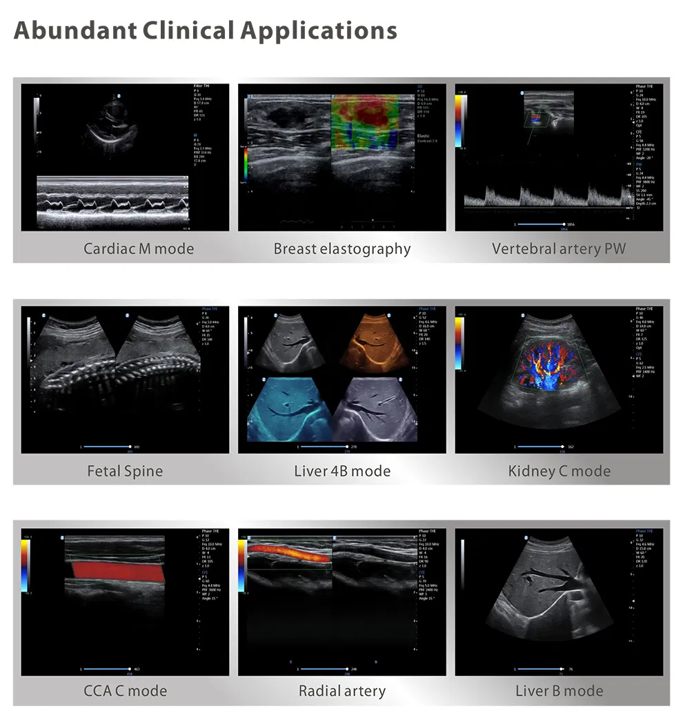 El Sistema de Diagnóstico Médico de Hospital de Precio Más Bajo Escáner Ultrasónico Portátil 3D 4D 5D Máquina de Ultrasonido Doppler Color Trolley
