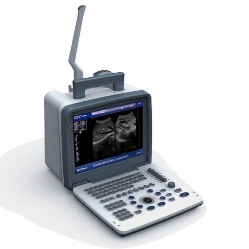 Máquina de ultrasonido portátil en blanco y negro