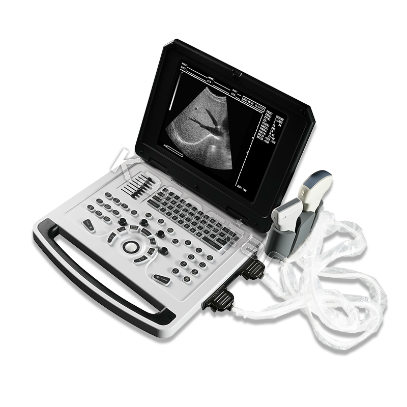 Equipo veterinario confiable, precio competitivo, alta calidad de imagen, máquina de ultrasonido portátil
