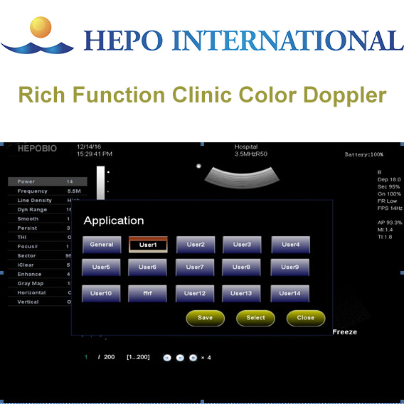 Sistema de Diagnóstico Ultrasonido Doppler Color Portátil de Clínica China 2D 4D