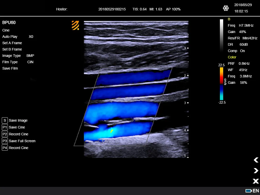 Ultrasonido Doppler Color 8