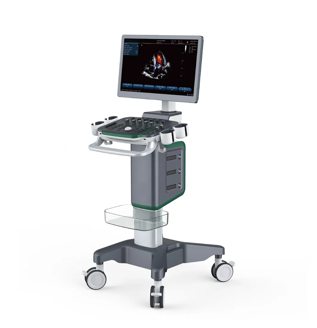 Dispositivo de Ultrasonido Médico de Imagen Digital Avanzada 4D Sistema de Diagnóstico Doppler Color Visual