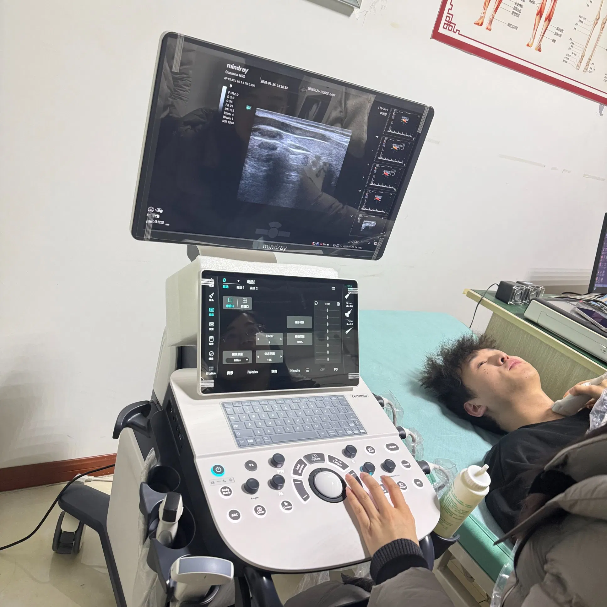 2026 Nueva Llegada Mindray Consona N5 Doppler Color 3D/4D Máquina de Ultrasonido
