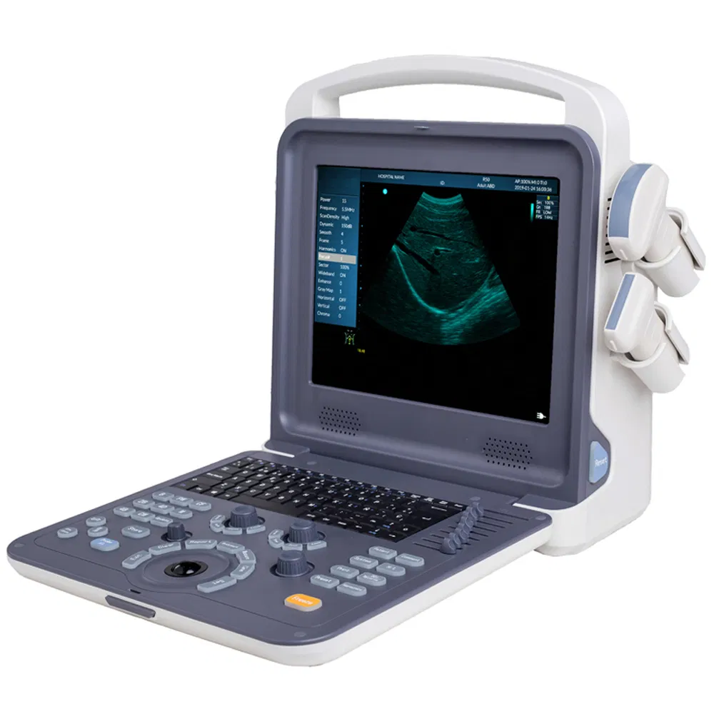 Precio de fábrica al por mayor sistema de diagnóstico ultrasónico Doppler color portátil digital completo