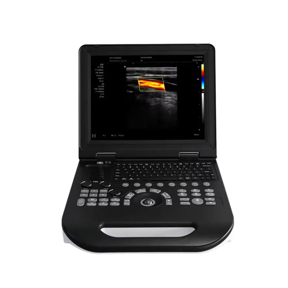 Máquina de ultrasonido portátil amigable para el usuario, escáner de laptop, Doppler color móvil, diagnóstico médico, sistema de alta definición