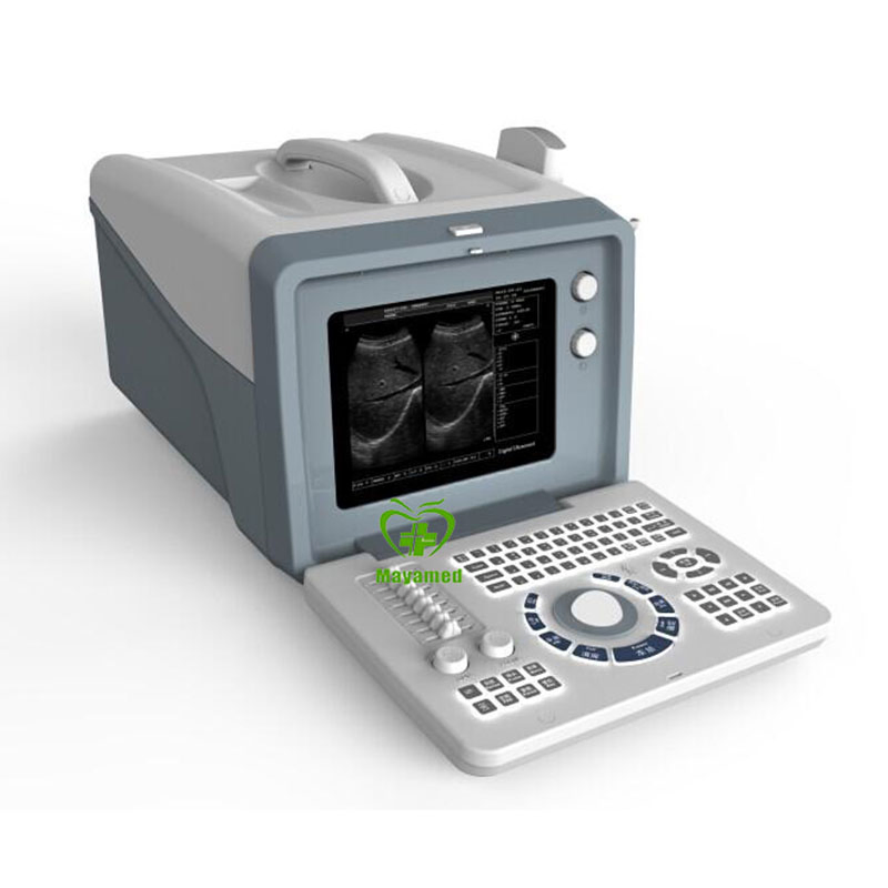 My-A001A Equipo de diagnóstico médico barato máquina de ultrasonido portátil