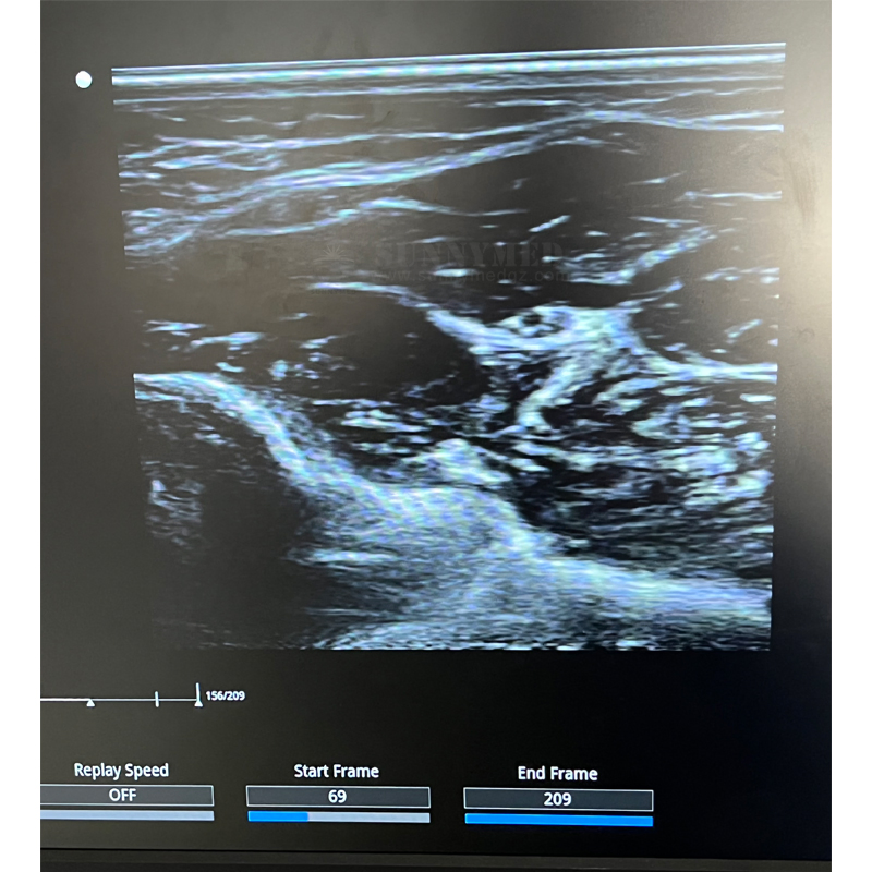 Sya-D40 Abdomen Cardíaco 4D Sistema de Ultrasonido Doppler Color Multifuncional con Pantalla Táctil para Pediatría
