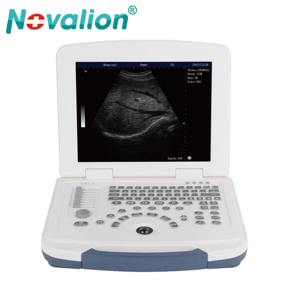 Precio de fábrica al por mayor Nl060701004A 12.1 Pulgadas Pantalla Médica 2D Máquina de Ultrasonido Portátil en Blanco y Negro