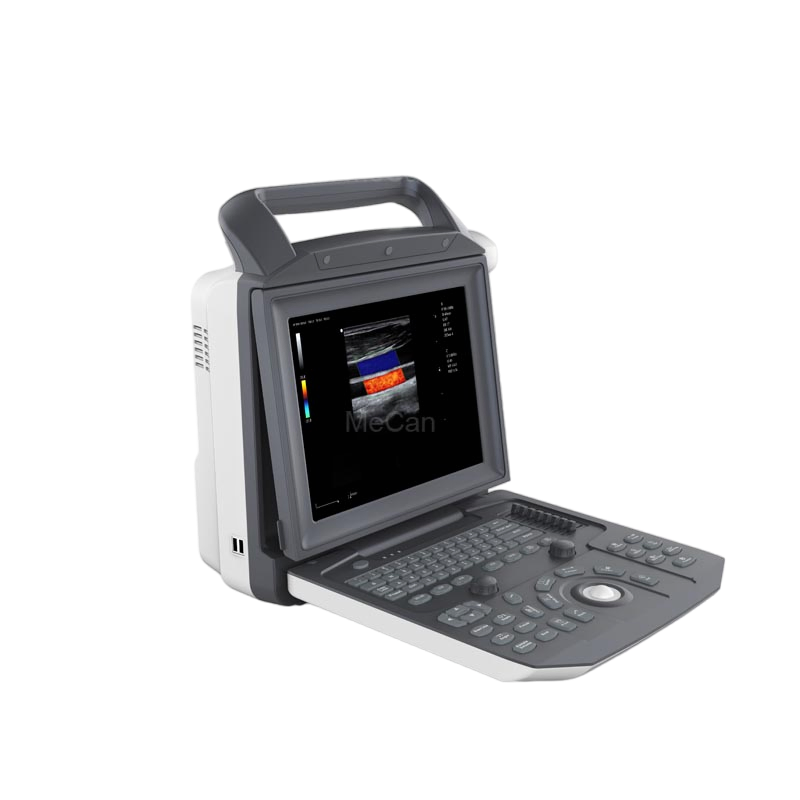 Venta Caliente Reparador de Sonda Doppler Vascular Cardiovascular de Abdomen Máquina de Ultrasonido Chison