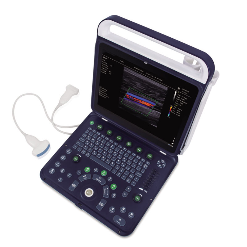 My-A027e Equipos de Diagnóstico Médico Abdomen Urología Máquina de Ultrasonido Portátil