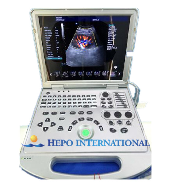 Sistema de escáner ultrasónico Doppler color portátil popular ruso 2D 3D