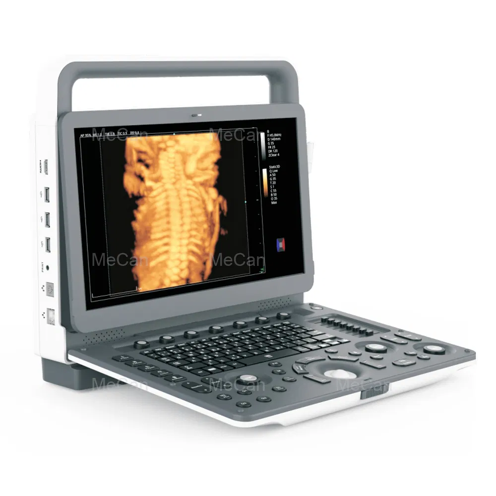 Máquina de ultrasonido cardíaco inalámbrica con pantalla táctil Doppler barata 3D portátil