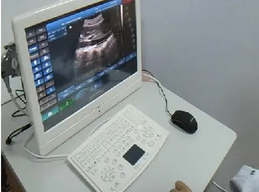 Escáner Ultrasonido Vista 1