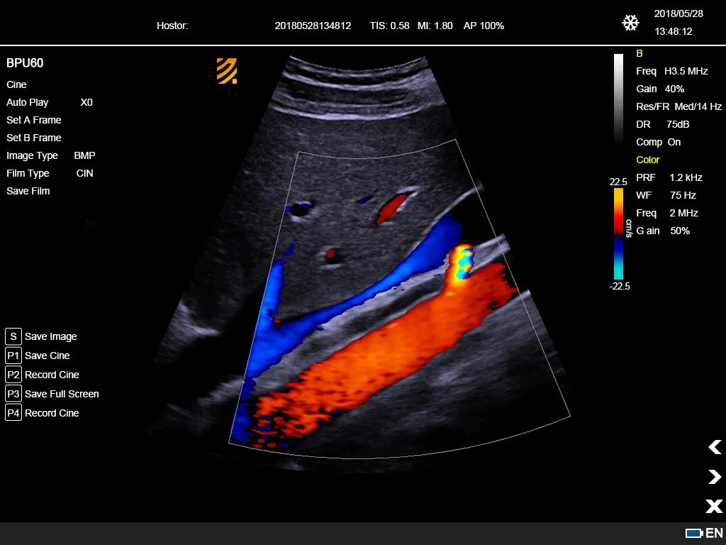 Ultrasonido Doppler Color 6