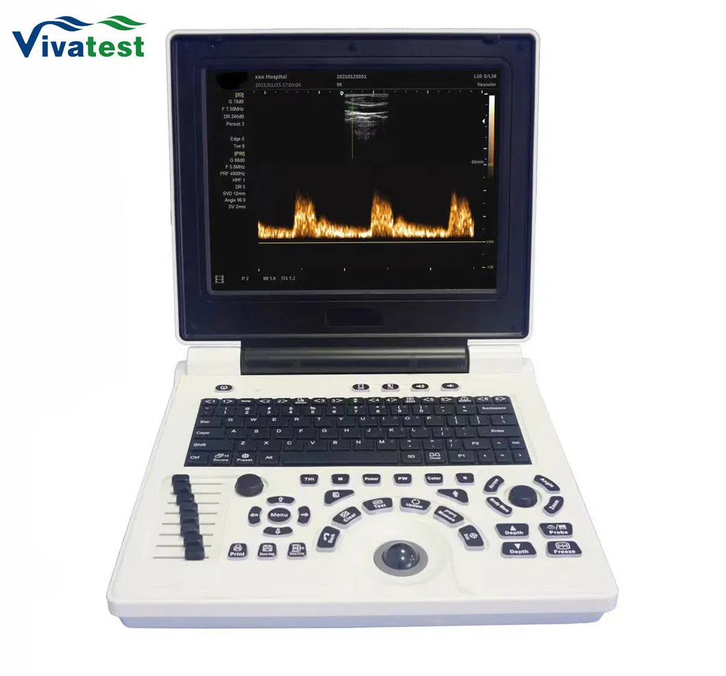Diagnóstico por ultrasonido Doppler 1