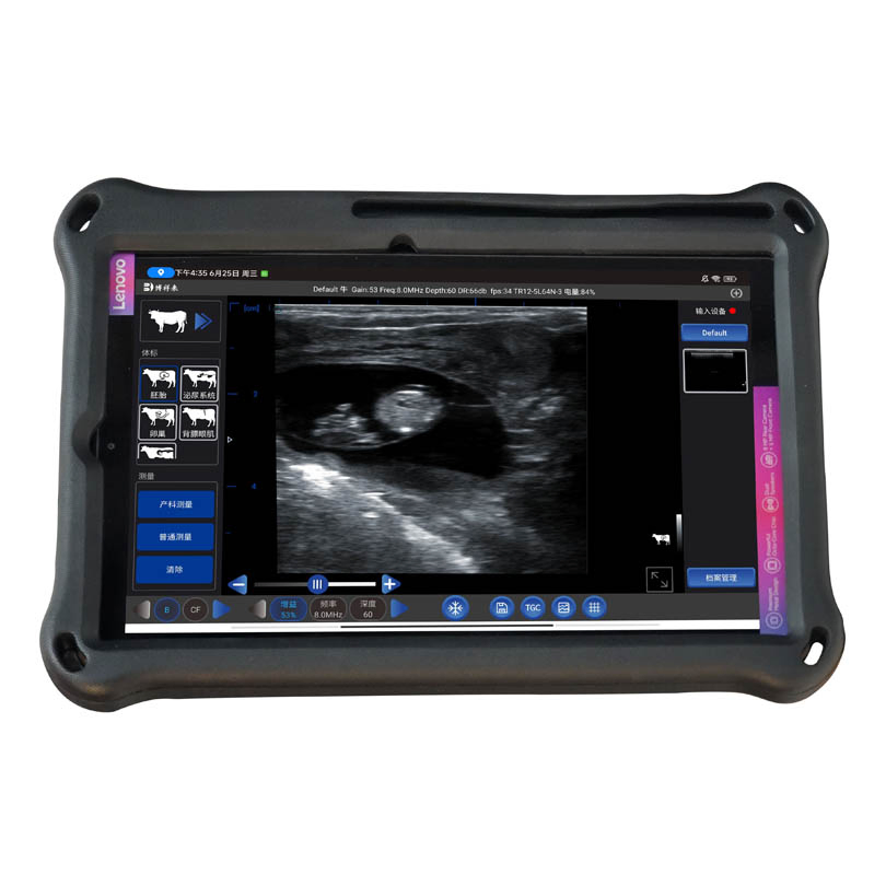 Bxl-S300 Sistema de Ultrasonido Ecuestre Inalámbrico para Ultrasonido Cardíaco Veterinario Doppler