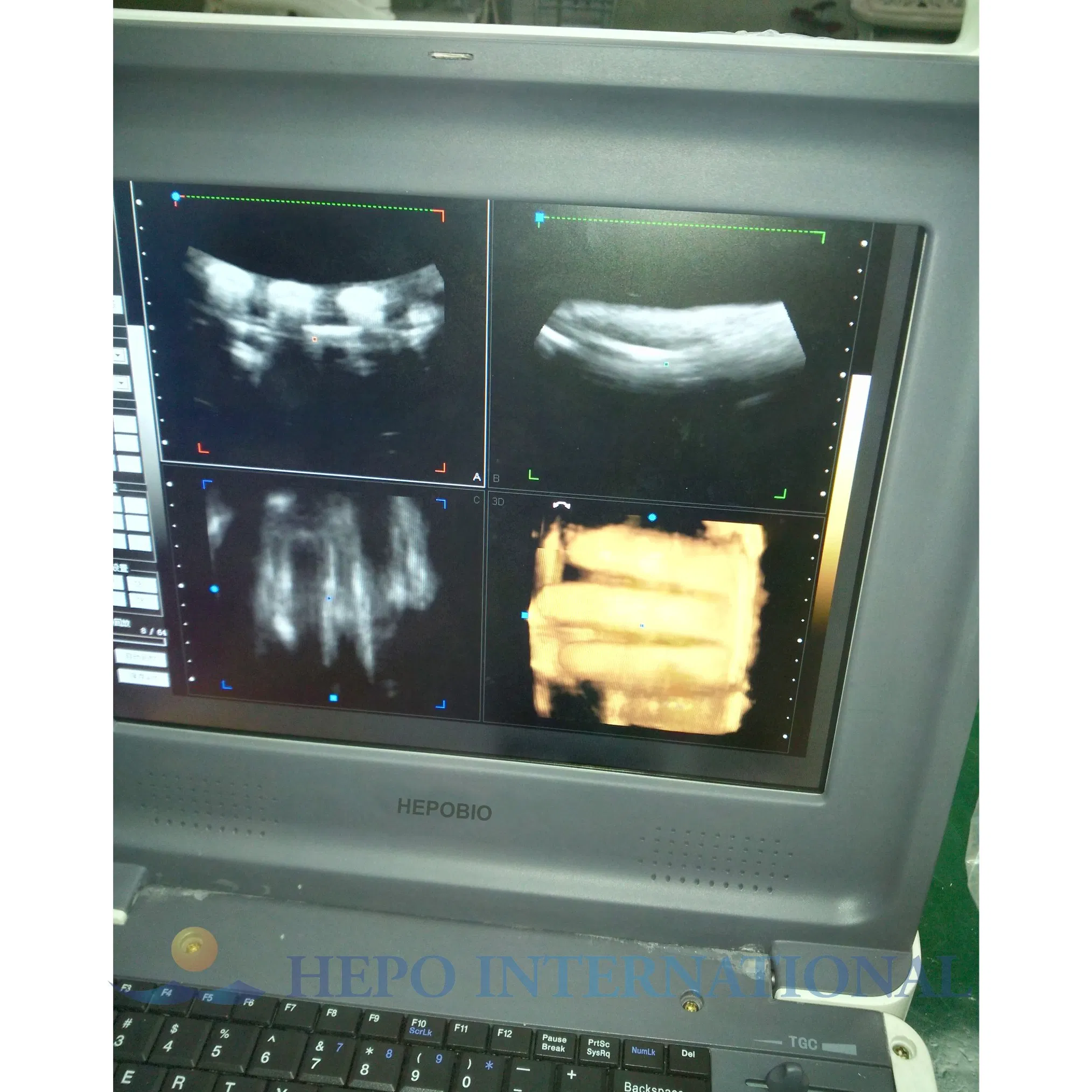 Sistema de Ultrasonido Doppler Color Portátil Cardíaco 4D para Hospital