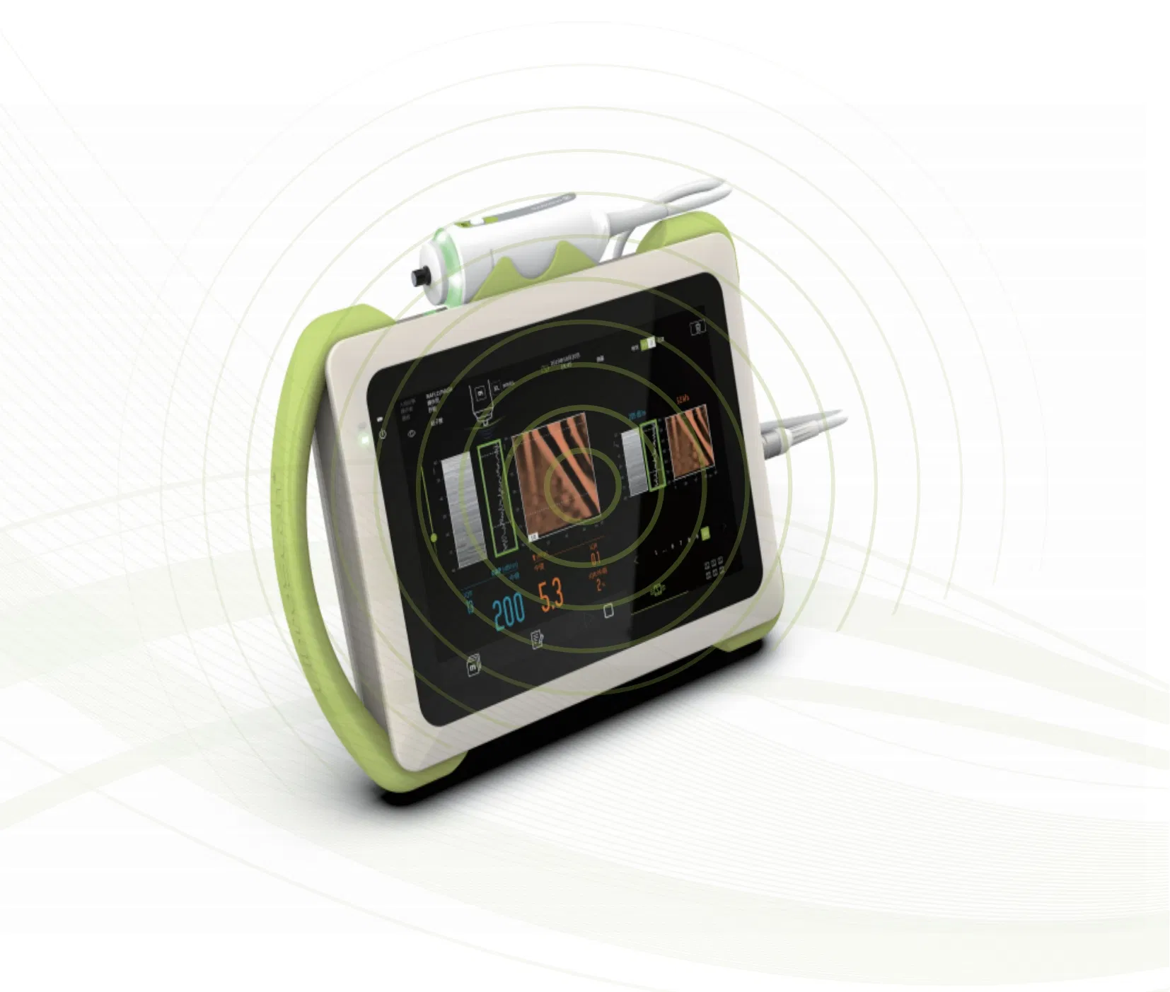 Fibroscan Mini Plus Detalle