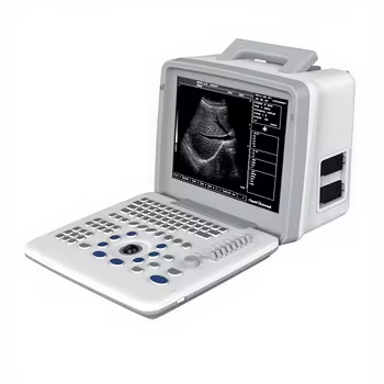 Máquina de ultrasonido avanzada en blanco y negro para diagnósticos precisos
