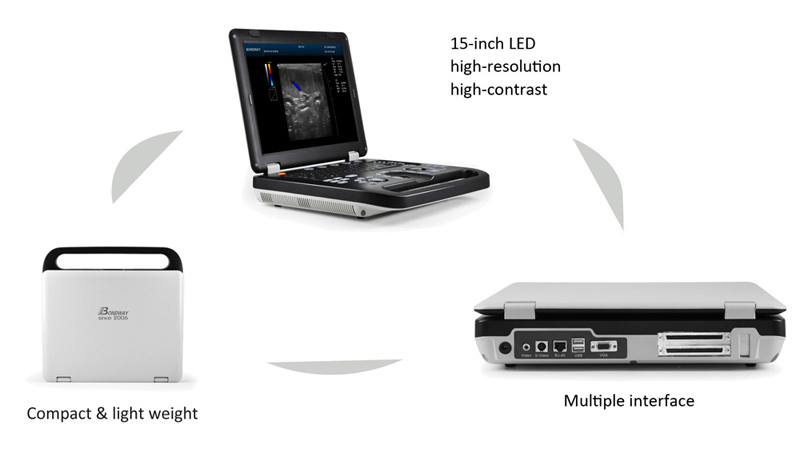 Sistema de Imagen Ultrasonido Doppler Color Digital para Laptop con 3D, 4D Función, Es230