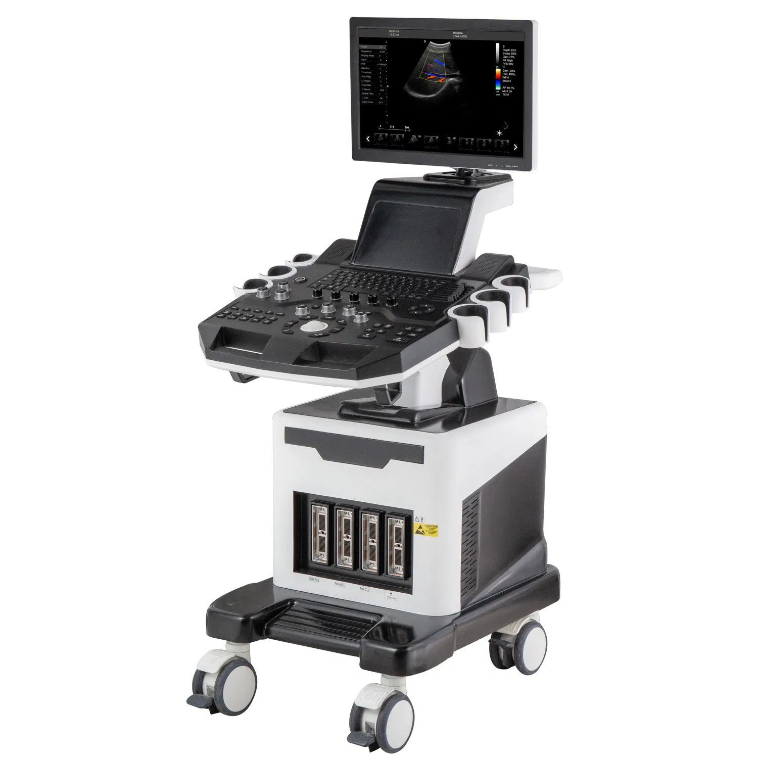 Carro de ultrasonido Doppler color para hospital 3D 4D