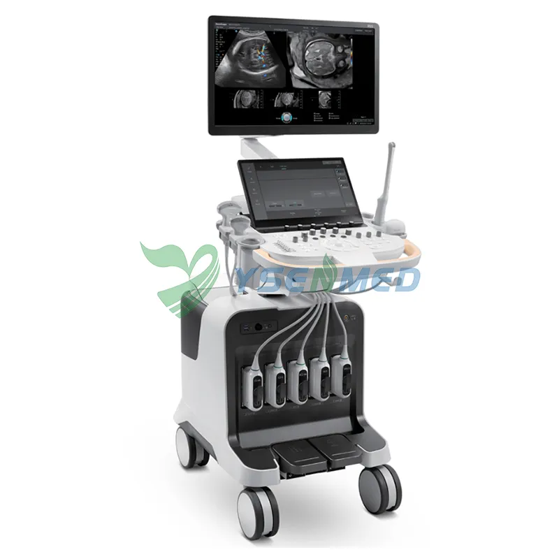 Sistema de Ultrasonido Doppler Color P80