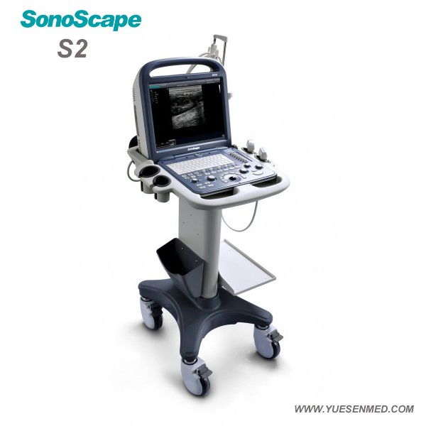 Equipo Veterinario de Hospital S2 Máquina de Ultrasonido Doppler Color Portátil