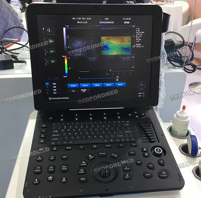 Sistema de Ultrasonido Doppler Color Digital Completo para Dispositivos Quirúrgicos de Hospital Me-P6