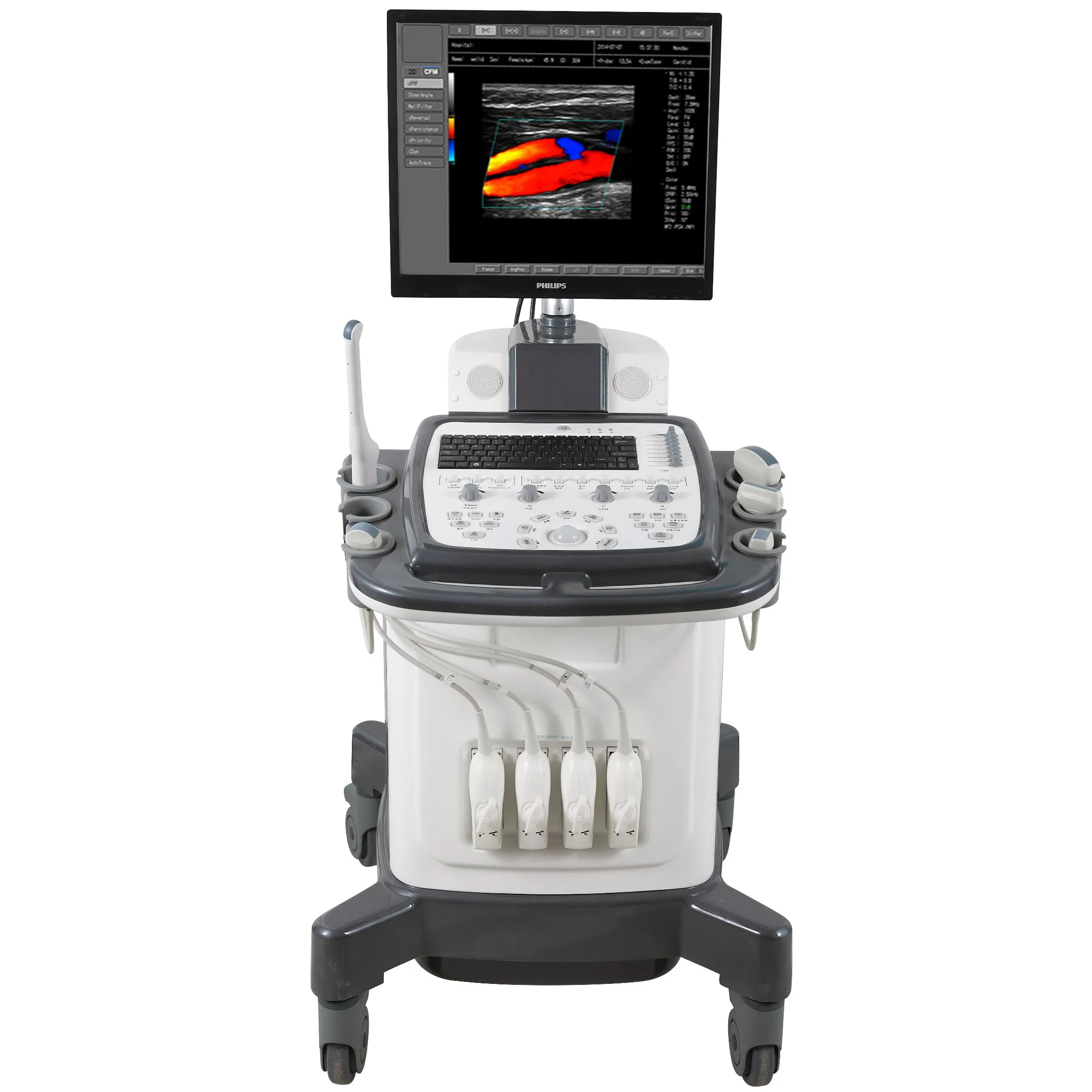 Sistema de Diagnóstico Médico Cardíaco Digital Hospitalario Escáner Ultrasónico Portátil 3D 4D 5D Máquina de Ultrasonido Doppler Color Trolley
