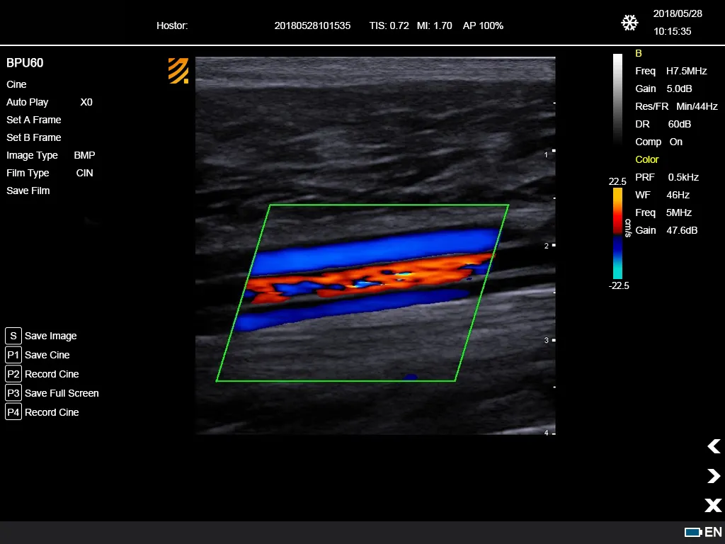 Ultrasonido Doppler Color 7