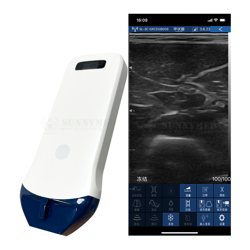Sy-AC51_P 128 Escáner ultrasónico de tipo sonda inalámbrica Elements para iOS, Android, Windows