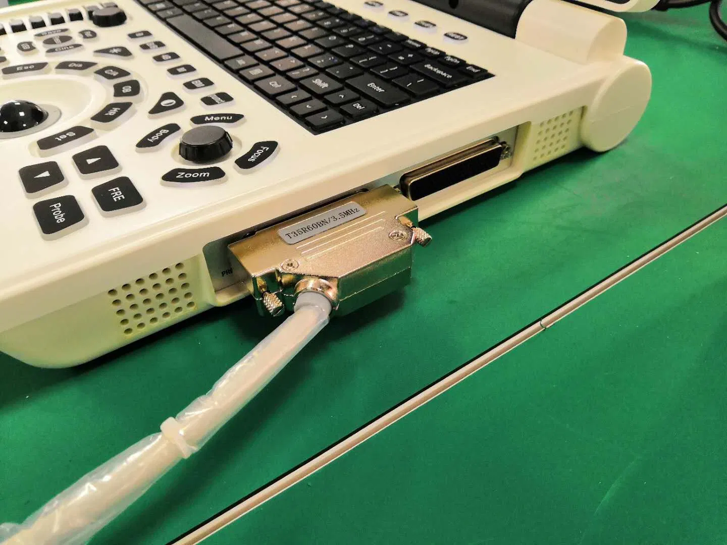 Máquina de escáner ultrasónico portátil Bw para hospital Xf30b con obstetricia y ginecología